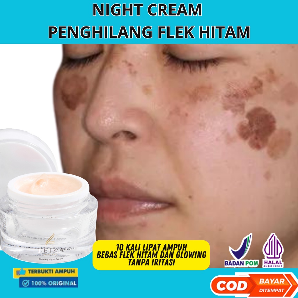 Cream Malam Penghilang Flek Hitam membandel Bpom Cream Penghilang flek hitam di wajah krim flek hita