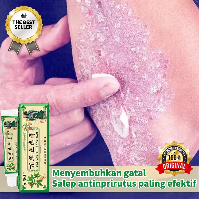 【100% ASLI】[BPOM]&amp;[COD]krim obat herbal alami mengatasi gatal, salep anti pruritus, salep eksim, salep kulit, salep antinprirutus paling efektif, salep psoriasis, psoriasis kulit kepala, kurap tangan, kulit infeksi jamur