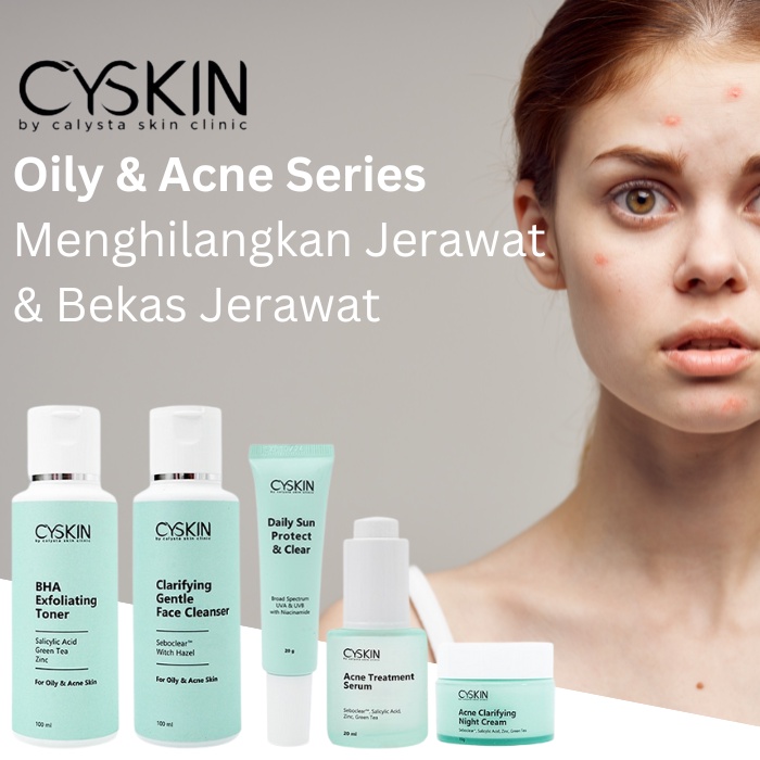 Anti Acne Yang Aman Cyskin Calysta Atasi Bekas Jerawat
