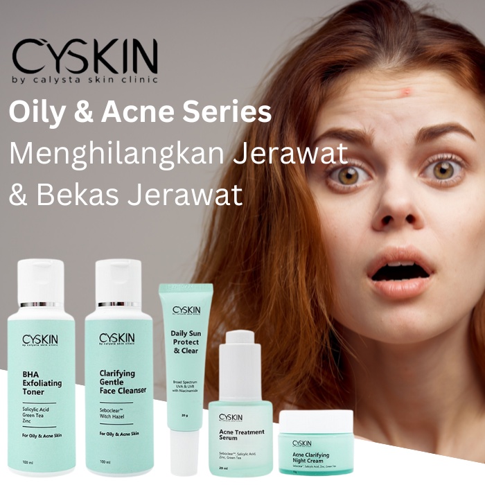 Krim Jerawat Mencerahkan Kulit Bpom