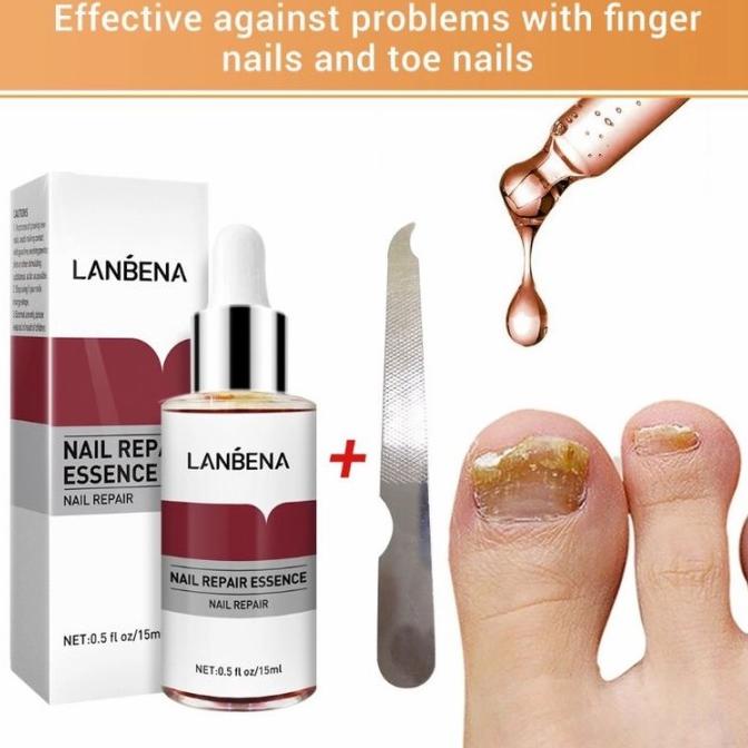 Lanbena Nail Repair Serum/ Serum Kuku/ Obat Jamur Kuku