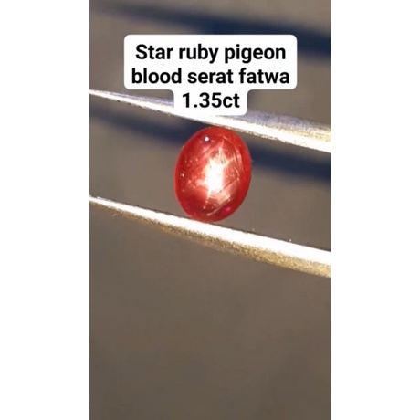 natural [STAR RUBY PIGEON BLOOD TOP STAR]emban cincin pria wanita ring emas perak