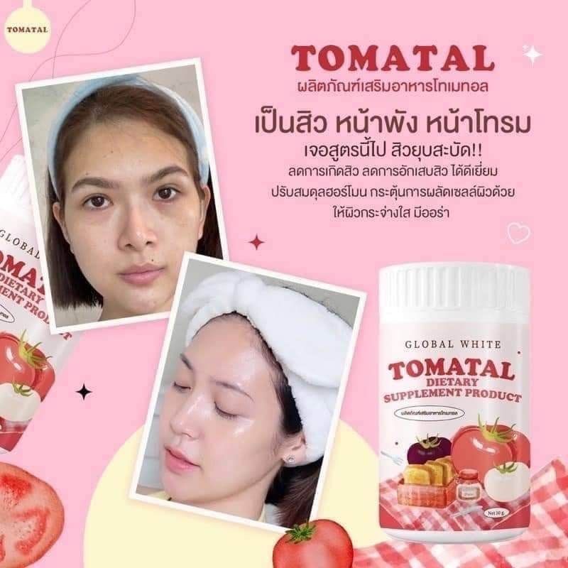 Tomatal Pelangsing Supplement/collagen/tomatal Thailand