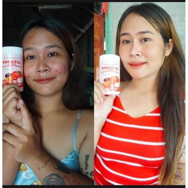 Tomatal Pelangsing Supplement/collagen/tomatal Thailand