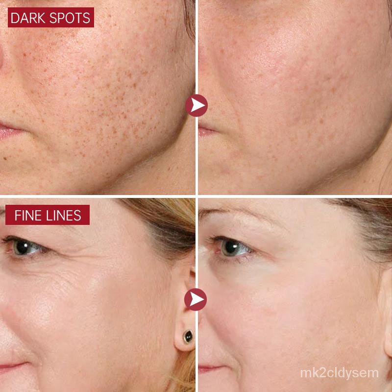 Niacinamide Krim Pemutih Perawatan Kulit, Emulsifier Peptida Anti Penuaan Krim Keriput Wajah Bintik