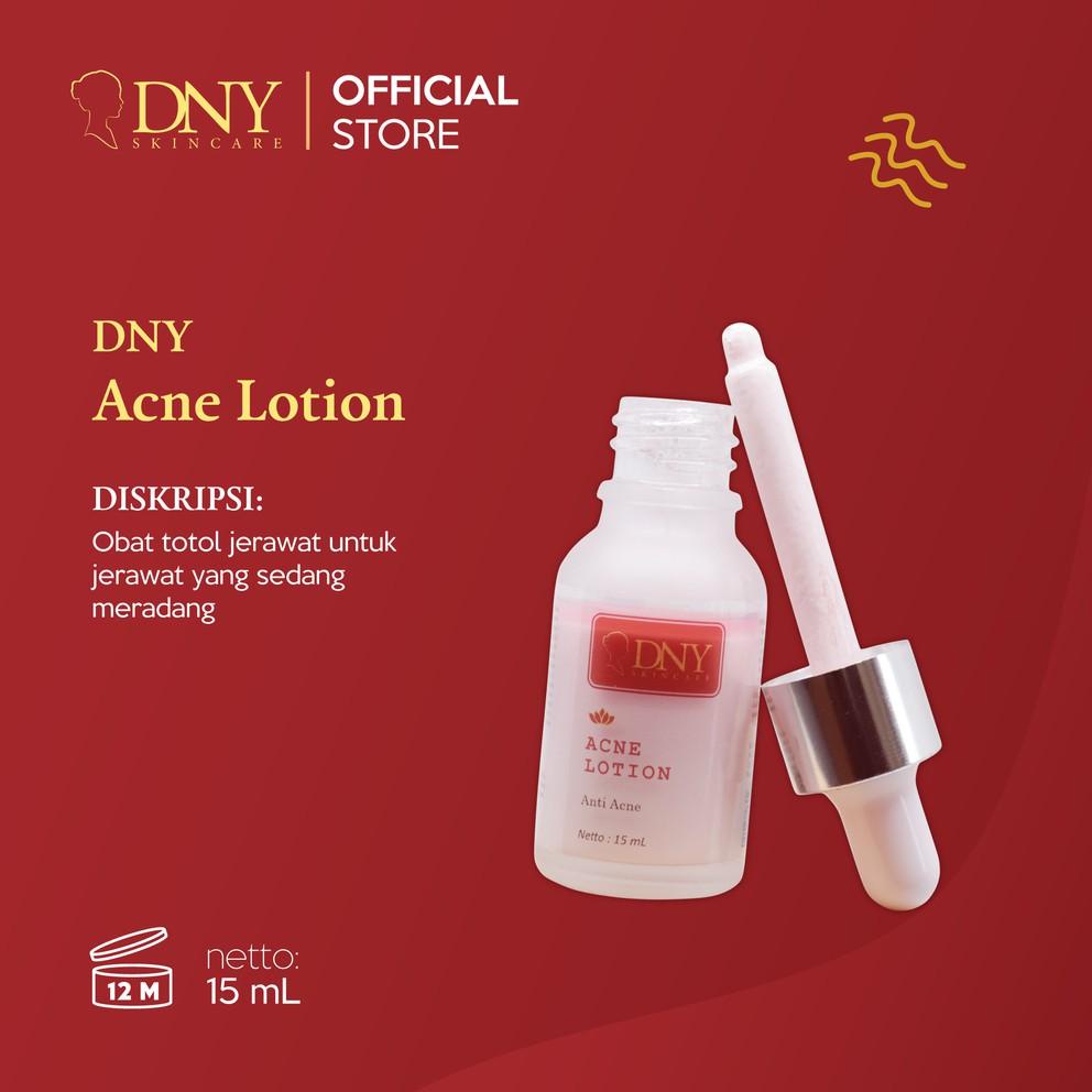 Termurah Dny Skincare Acne Lotion