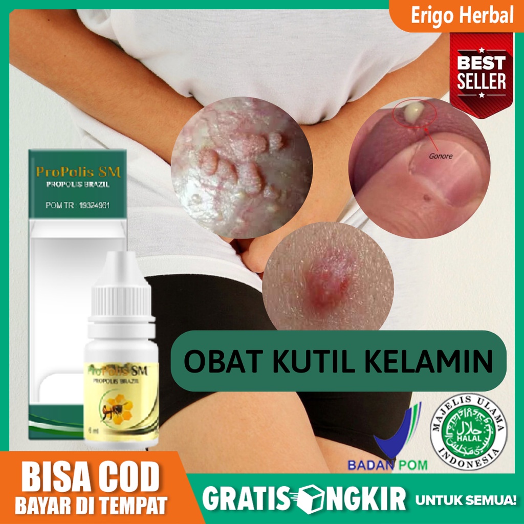 PROPOLIS SM 100% ASLI - Obat Kutil Kelamin Pria & Wanita - Perontok Kutil Kelamin - Kutil Kelamin An