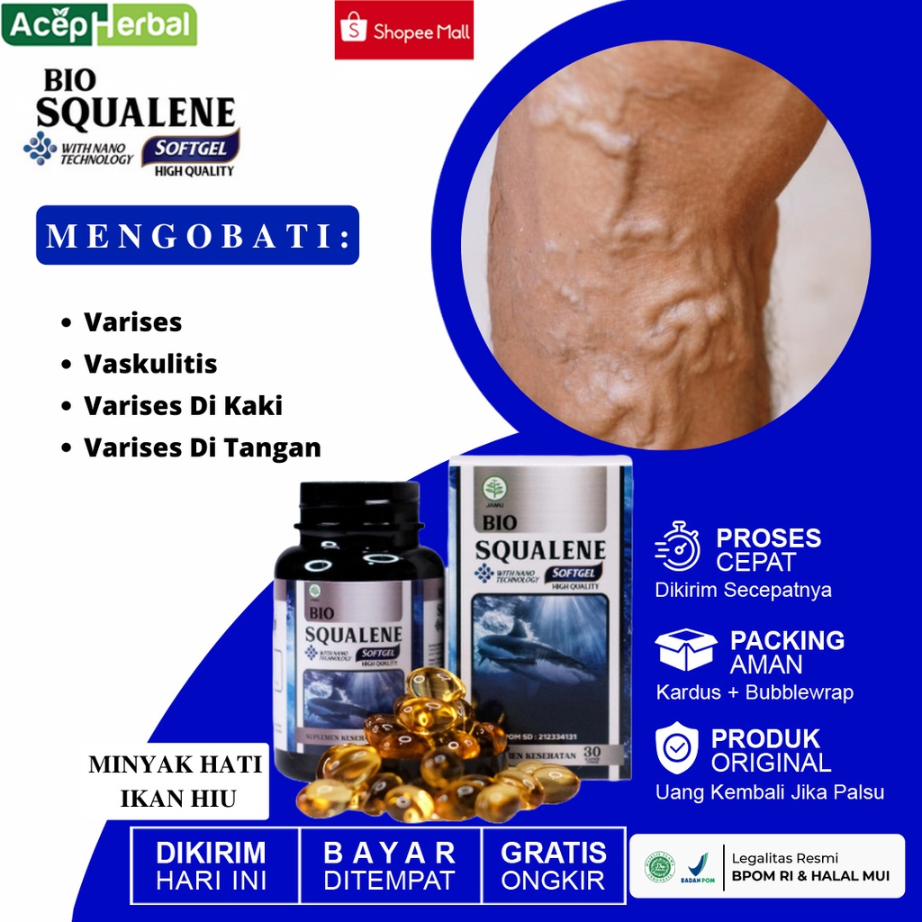 Obat Varises Obat Penghilang Varises Vaskulitis Obat Varises Kaki Obat Varises Di Betis Kaki Obat Va