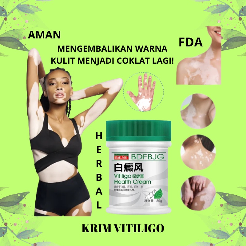 Cream Penyakit Vitiligo - Salep Kulit Vitiligo, Pemudar Bercak Putih di Tubuh Wajah Lengan dan Kaki,