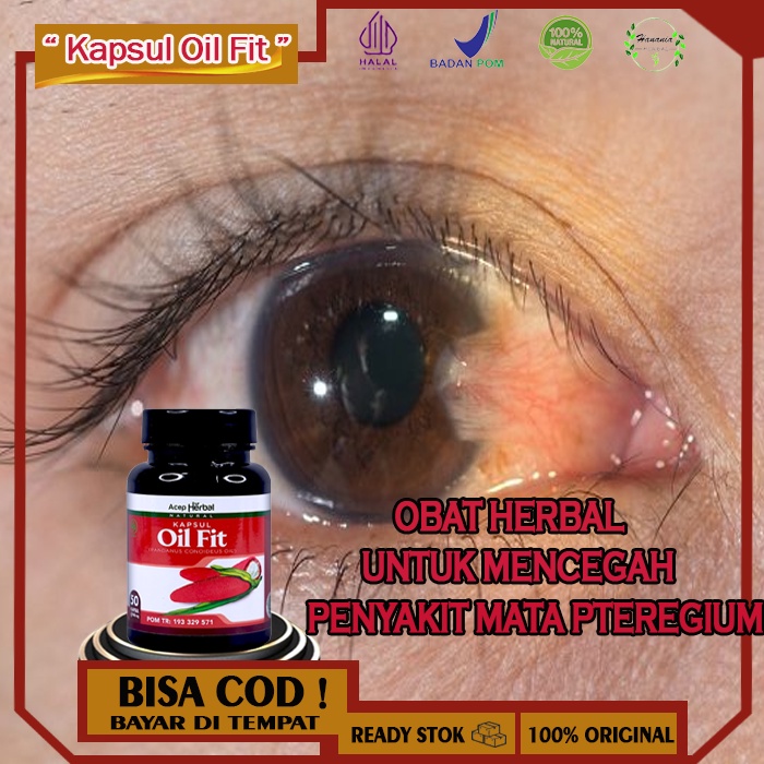 Obat Mata Pterigium, Oil Fit Kapsul Asli Obat Herbal Mata Berlemak, Obat Mata Berlemak Berselaput, O