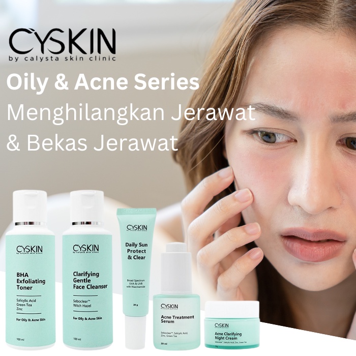 Paket Acne Cyskin Fash Wash Jerawat Meradang Calysta Skin Clinic