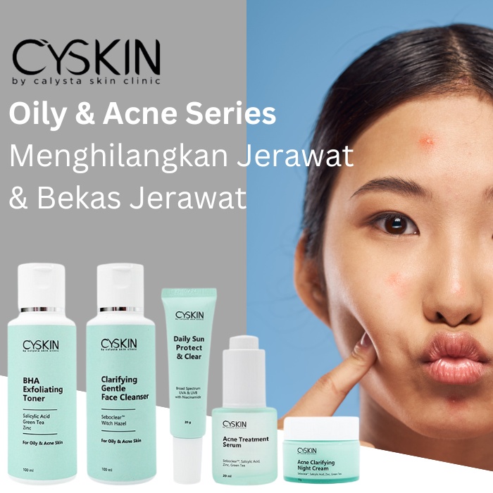 Paket Acne Cyskin Cream Wajah Berjerawat Meradang Calysta