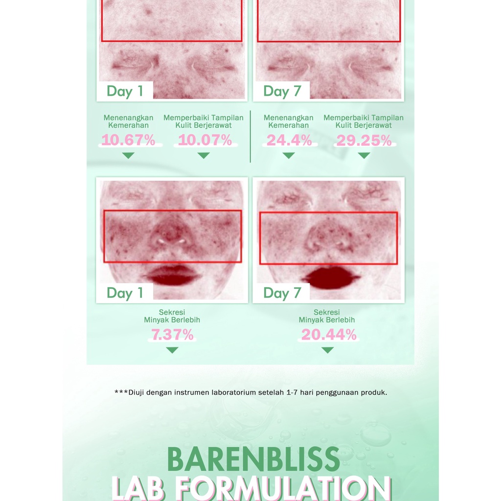 [BPOM] [100%ORI&amp;READY]BNB barenbliss Pimple Warrior! Salicylic Acid Acne Drying Lotion - Acne Spot Treatment Care