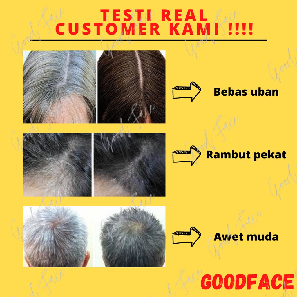 NOVE PAKET PERAWATAN 2IN1 RAMBUT UBAN SHAMPOO TONIC PAKET NOVE