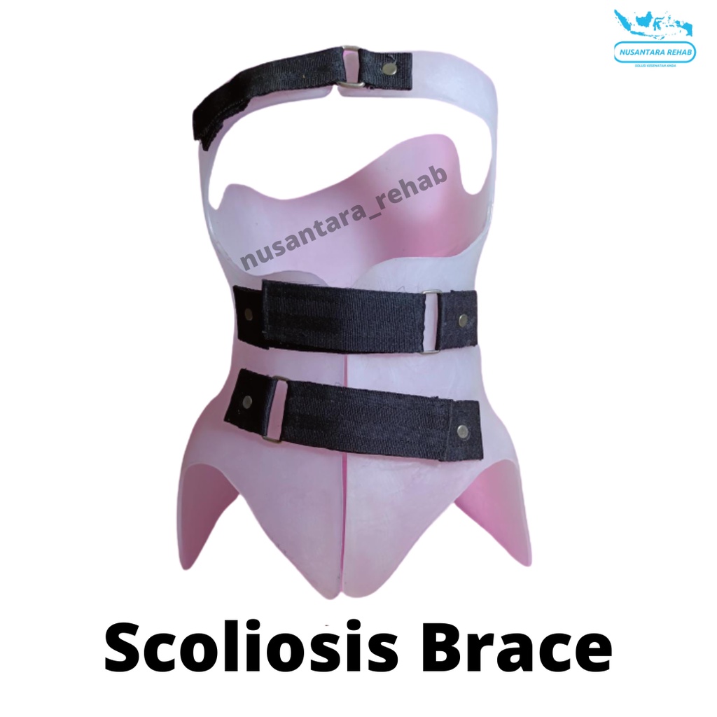 Skoliosis Brace custom Alat terapi skoliosis tulang bengkok