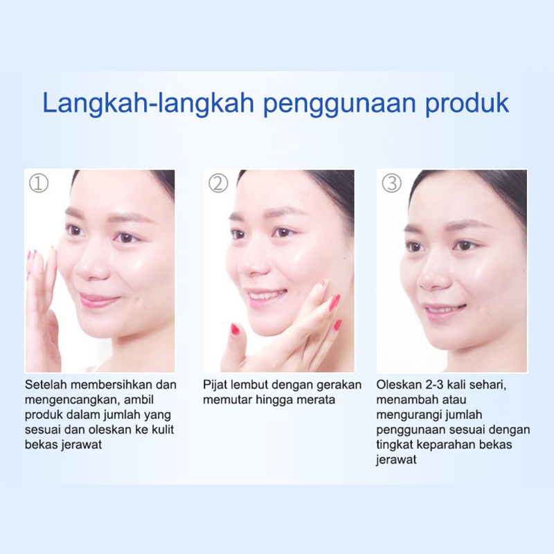 Serum Acne Obat Jerawat Obat Totol Jerawat 30g Herbal Obat Jerawat Dan Bekas Jerawat Obat Jerawat Dan Bekas Jerawat Paling Ampuh