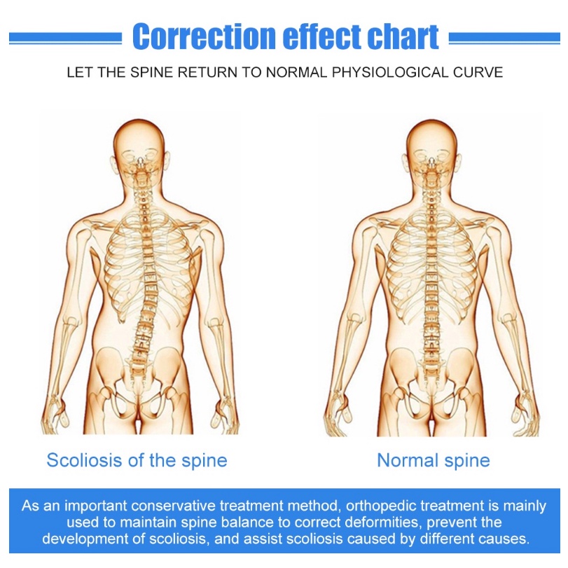 ⚡Ober scoliosis brace tandu orthosis fiksasi tulang belakang pasca operasi penjepit fiksasi skoliosis lumbar Disesuaikan Untuk Pemulihan