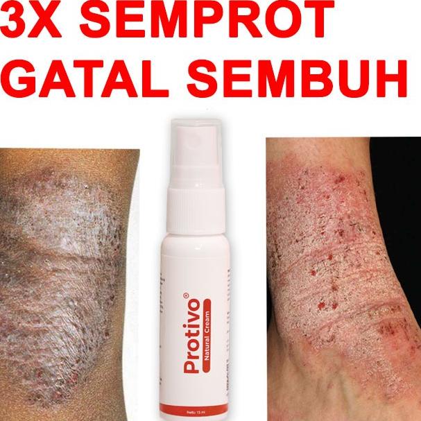 TERMURAH  Protivo Natural Cream | Obat Gatal | Salep Gatal | Cream Gatal | Obat Kulit Gatal | Obat G