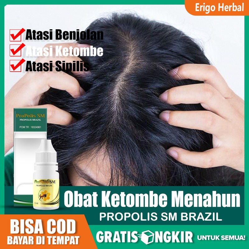 Obat Ketombe Menahun, Ketombe Parah, Ketombe Berkerak Yang Aman Propolis Di Tangerang