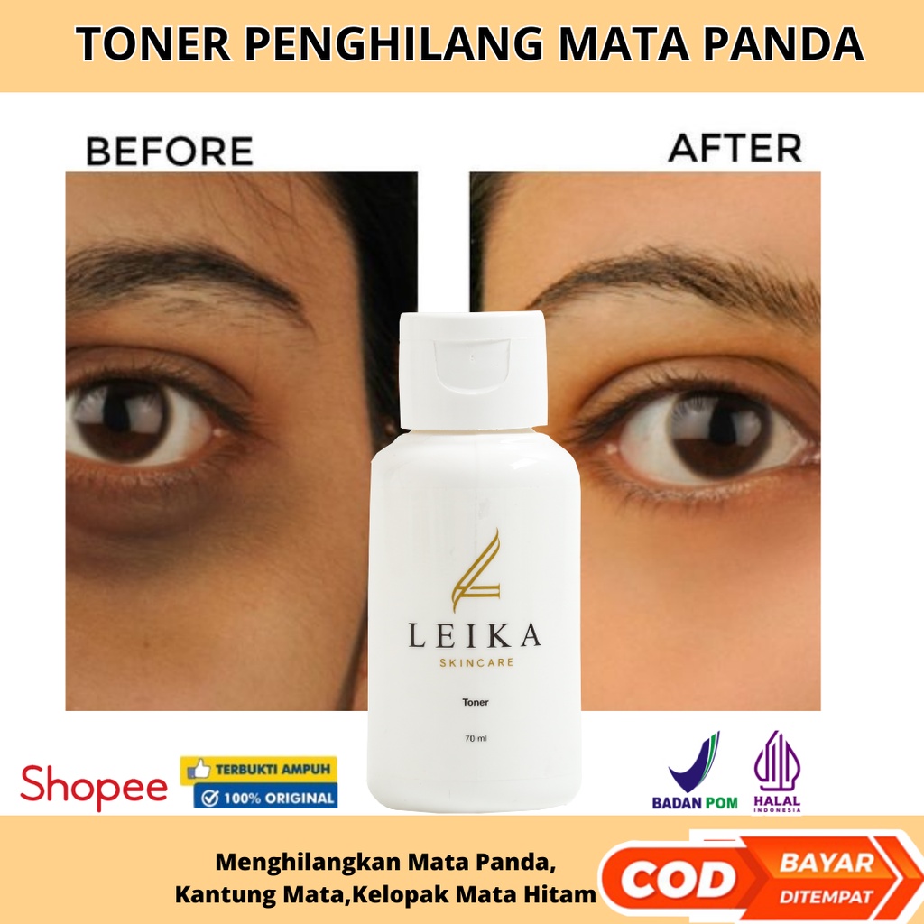 Toner Leika Skincare Penghilang Mata Panda Bpom Penghilang Kantung Mata Penghilang Jerawat & Bekas J