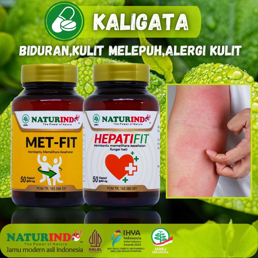 Obat biduran kaligata alergi dingin kulit melepuh gatal bintik  merah bentol kadas kurap jamur kulit