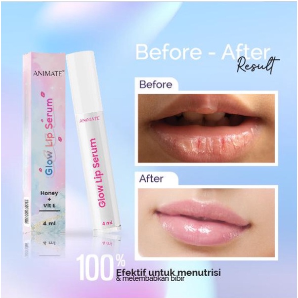 ANIMATE Exclusive Glow Lips Serum - Serum Bibir Lippie - Bibir Merah Sehat