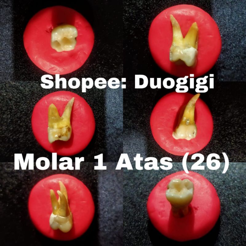 (NEW) Gigi Asli Praktikum Molar