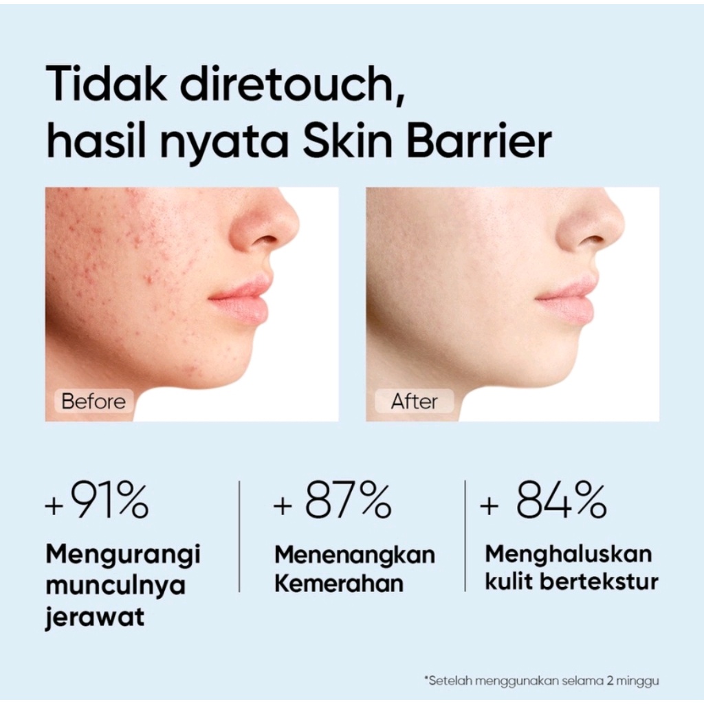 Skintific 5X Ceramide Barrier Repair Moisturizer Gel 30g Moisturizer Cream Pemutih Wajah