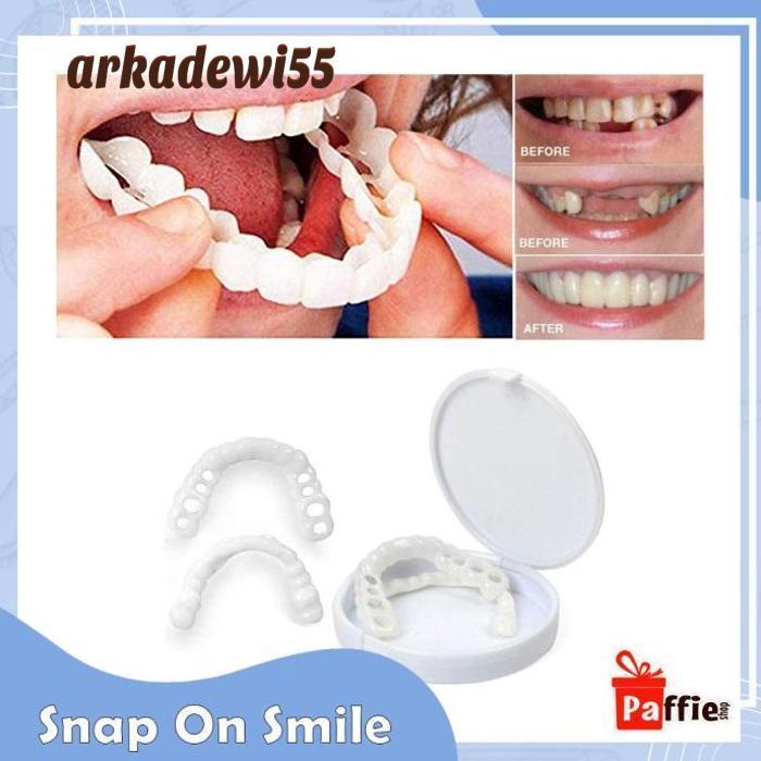 Snap On Smile Veneer Instan Gigi Palsu Tiruan Kesehatan Mulut Mouth Ok