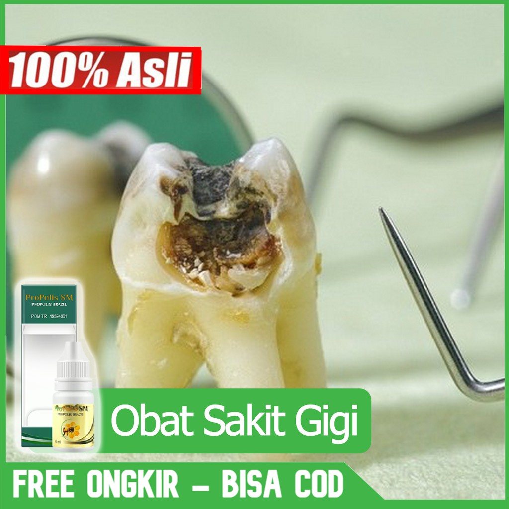Obat Sakit Gigi Berlubang - Obat Gigi Berlubang - Obat Gigi Sakit - Obat Sakit Gigi - PROPOLIS SM