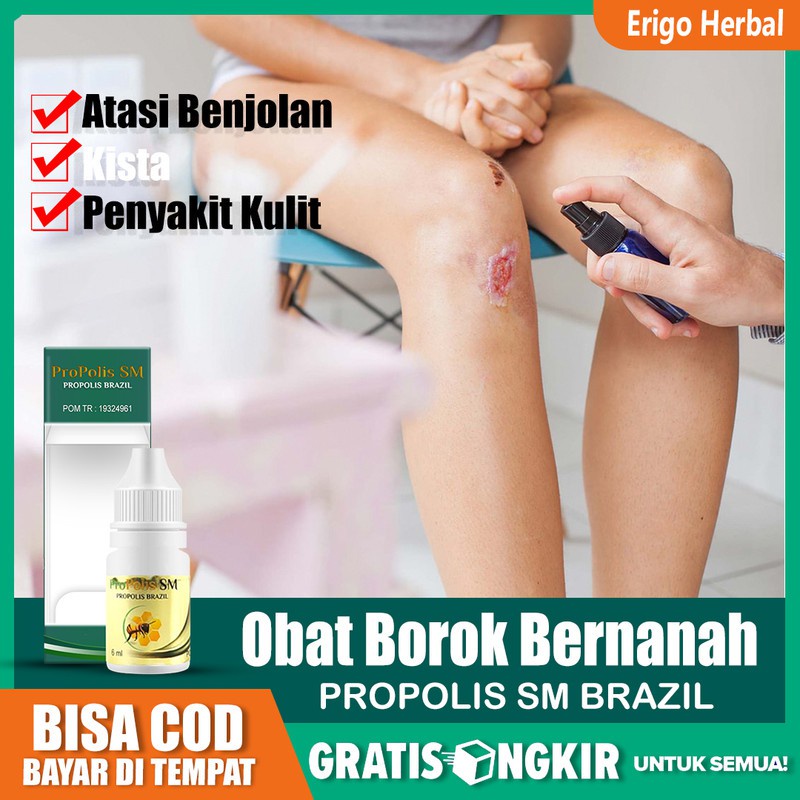 Obat Borok Bernanah Di Kepala Kulit Kepala Gatal Infeksi Kepala Terlaris Propolis SM Di Tangerang
