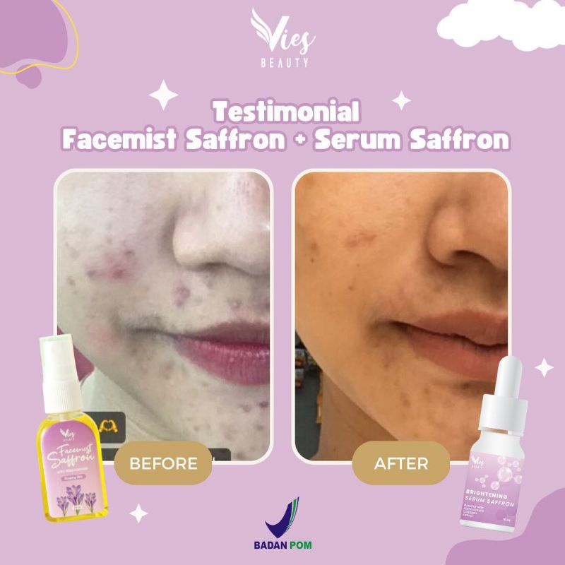 TERMURAH Serum Safron By Vies | Glowing Kenyal &amp; Melembabkan Wajah