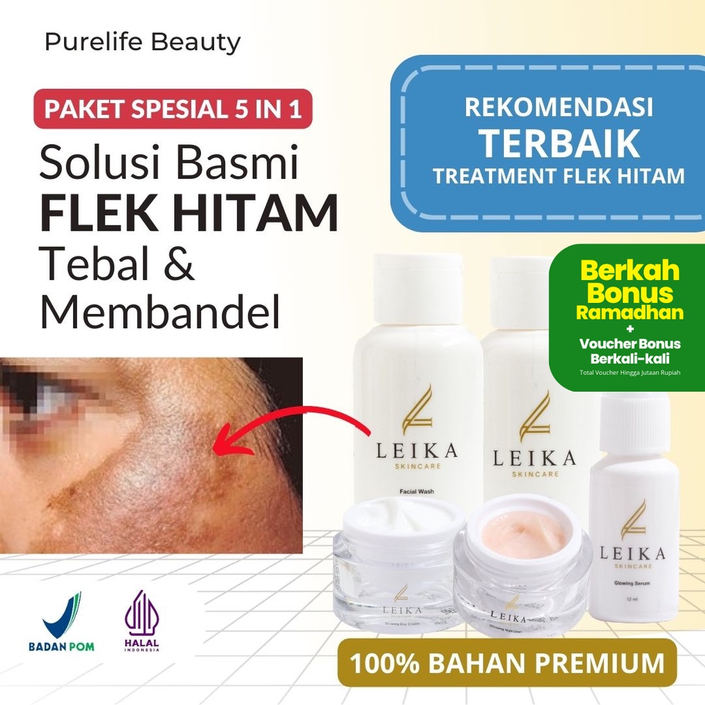 Paket Skincare Plek Hitam Membandel Menahun BPOM AMPUH Paket Leika Skincare Halal Obat Flek Hitam