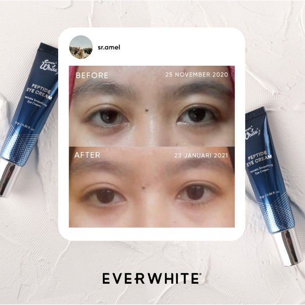 Everwhite Peptide Eyecream Gel with Ceramic Applicator 10gr