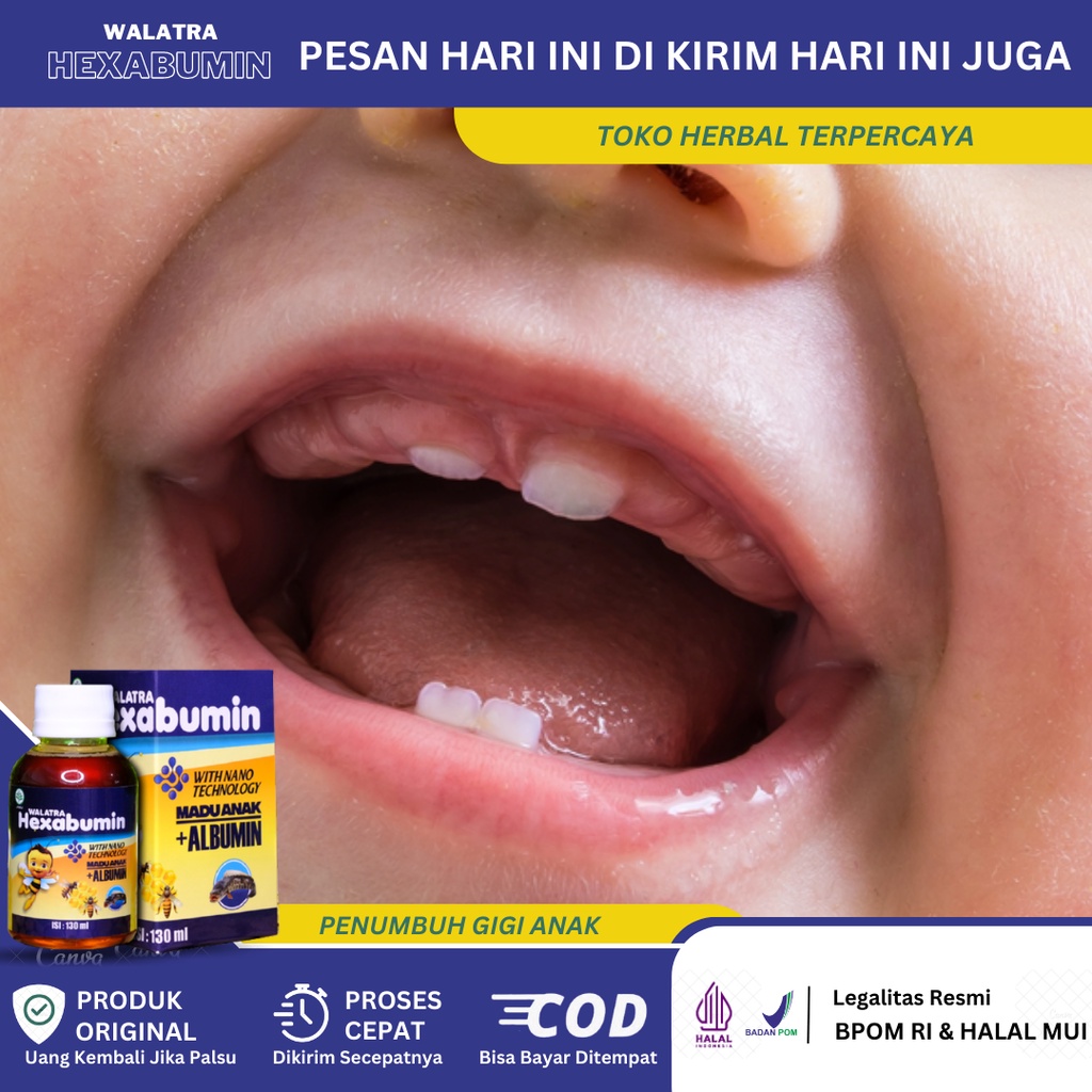 Obat Penumbuh Gigi Anak, Obat Mepercepat Tubuh Gigi Anak, Obat Penumbuh Gigi Ompong Anak, Obat Agar 