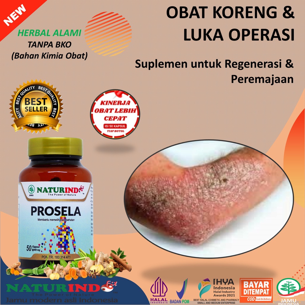 Suplemen untuk Regenerasi & Peremajaan Sel PROSELA Naturindo