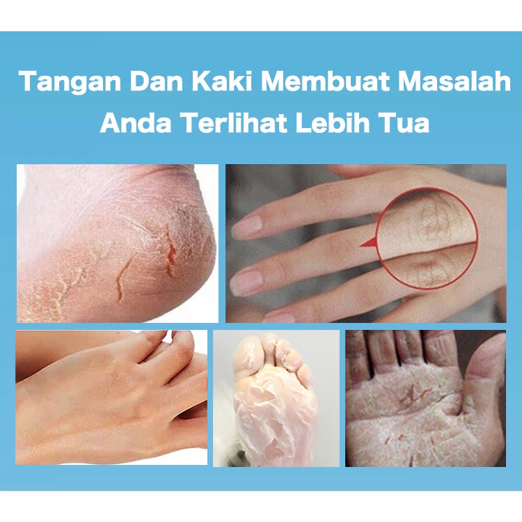 Stik Pelembab Vaseline Peach-Mengatasi Persendian Tangan Dan Kaki Yang Pecah-Pecah/Terkelupas/Hitam