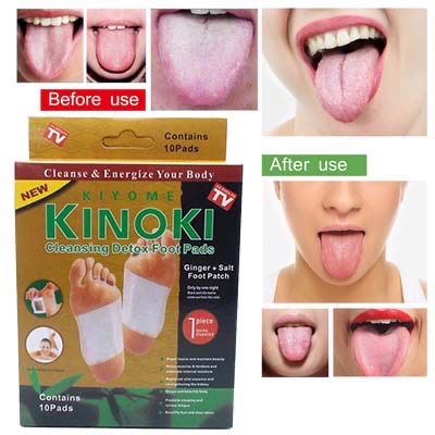 LUCKYMALL KINOKI GOLD WHITE KUNING EMAS PUTIH PENYERAP RACUN DALAM TUBUH DETOX KAKI ORIGINAL FOOT PADS HERBAL CLEANSING JAHE GINGER ORIGINAL