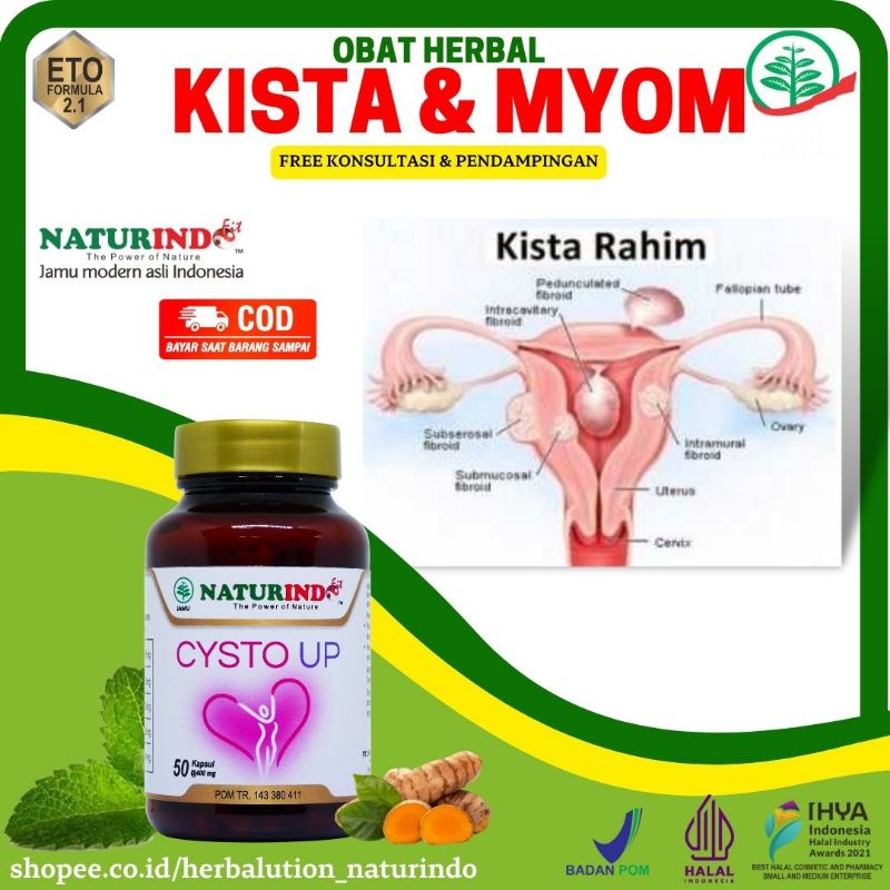 Obat Kista Ovarium Obat Kista Obat Miom Dan Kista Yg Paling Ampuh Cysto Up Obat Kista Bartholin Obat