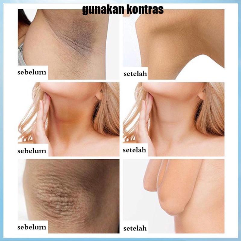 krim ketiak krim pemutih memutihkan melembabkan menghilangkan melanin lengan paha lutut pemutih ketiak menghilangkan selangkangan