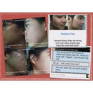 Refill ( isi Ulang ) Strong Acidic Water 500ml By Kangen Water