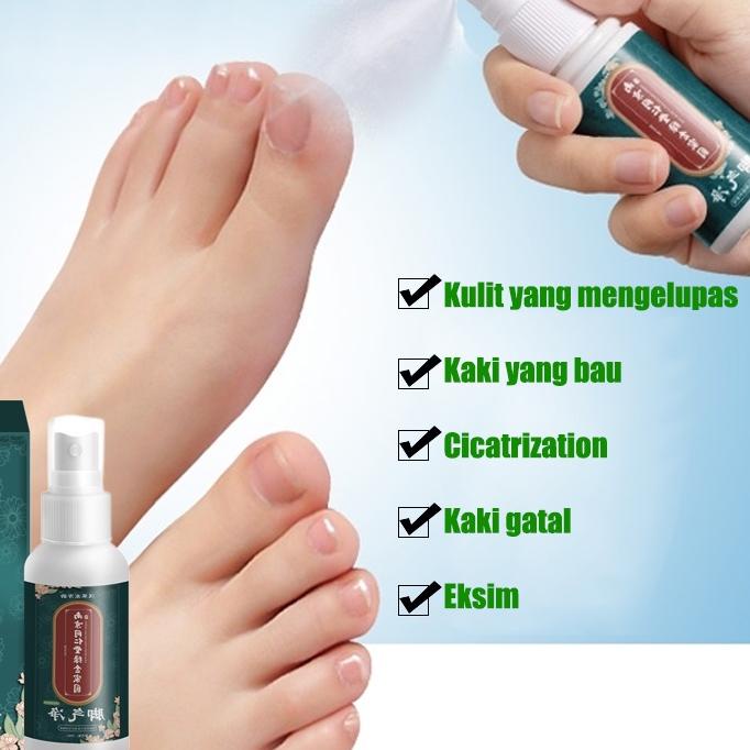 FLASH SALE Deodoran kaki Penghilang bau kaki 35ml Obat bau kaki Butuh deodorant spray Ampuh Menghila