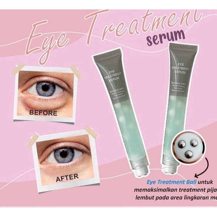 ❀Serba Murah ADNOW EYE TREATMENT MS GLOW / CREAM MATA PANDA MS GLOW E72 Terkini