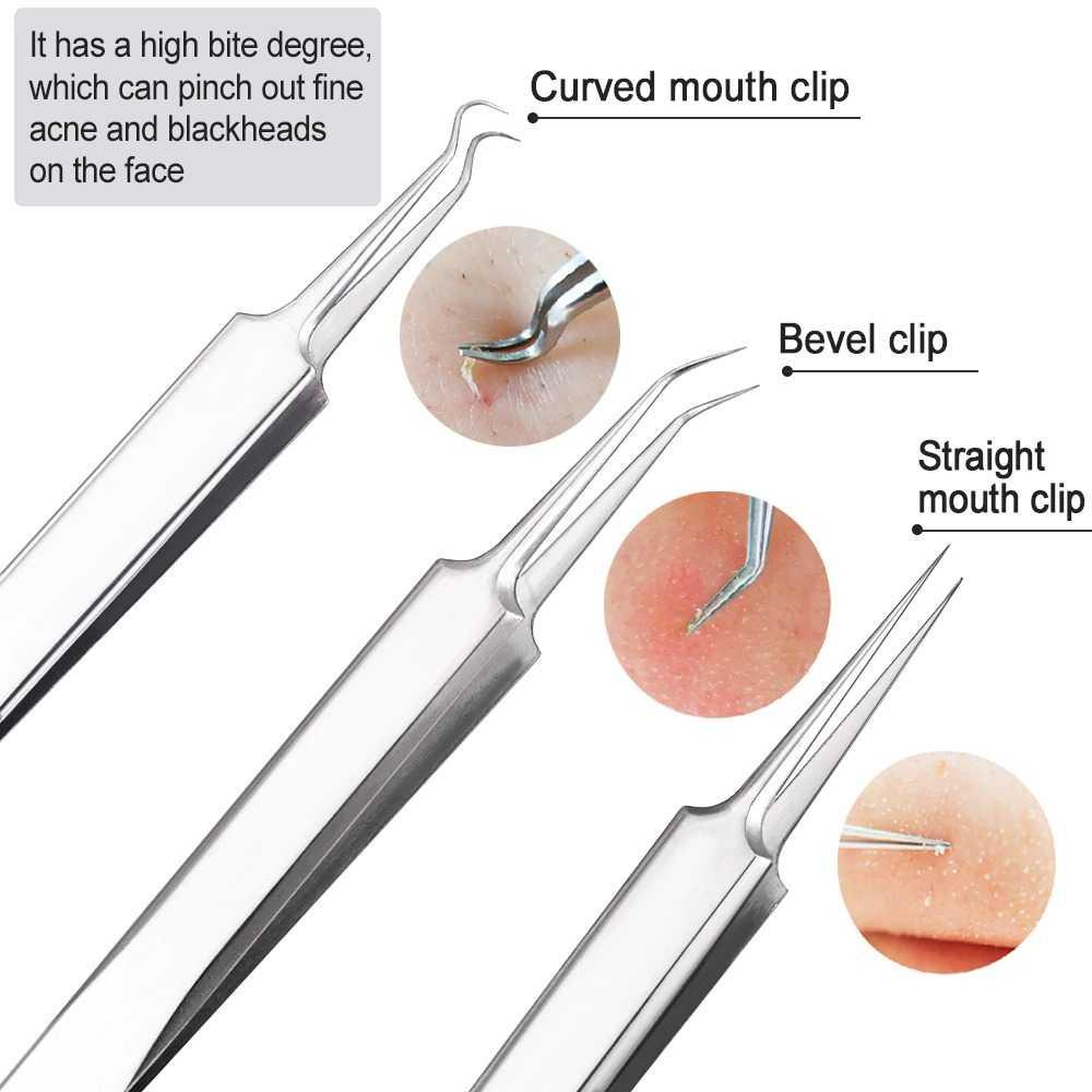 FEITA Alat Perlengkapan Komedo Jerawat Blackhead 7 PCS - PT8