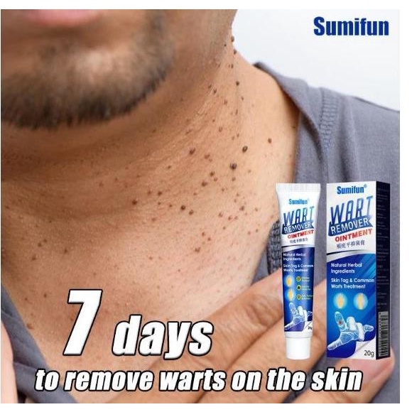Wart Remover Ointment Skintag remover Original Penghilang Kutil rah