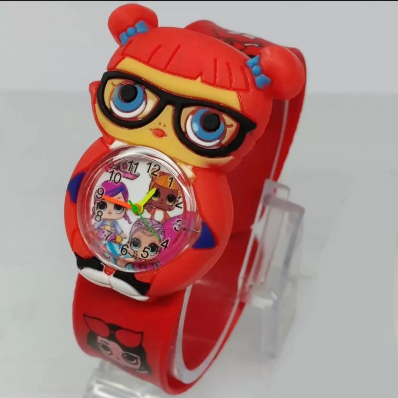 Jam Tangan Anak Perempuan Ceplok Tepuk Karakter Lol