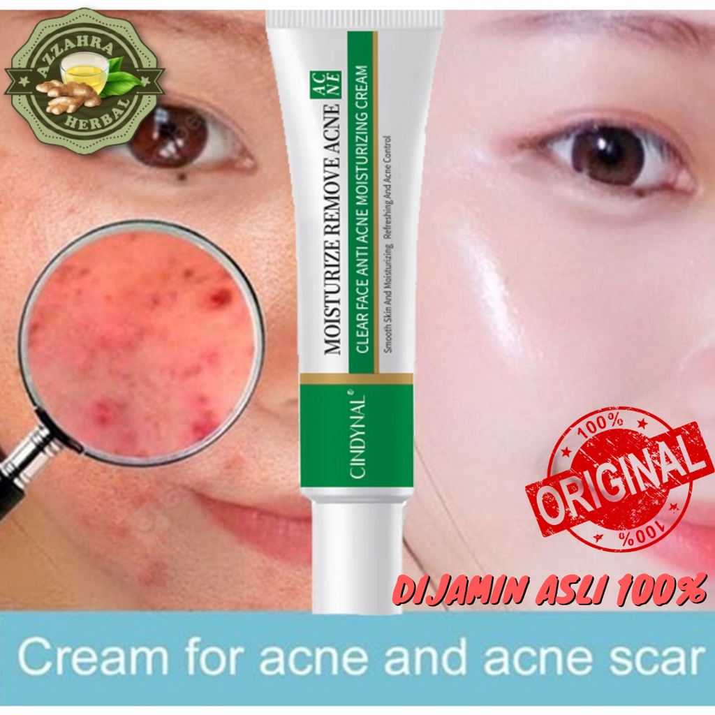 Cream Obat Jerawat AMPUH 𝐎𝐑𝐈𝐆𝐈𝐍𝐀𝐋 CINDYNAL Clear Face Anti Acne Moisturizing Pori-Pori / Gel Kontrol Minyak