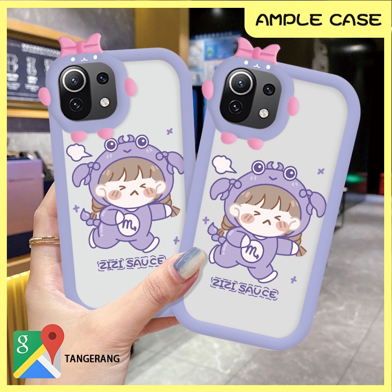 Casing Xiaomi 11 Lite Poco X3 GT Poco X3 NFC Poco X3 Pro Poco M3 Pro 4G/5G POCO M2 M4 Pro 5G M5S Poc