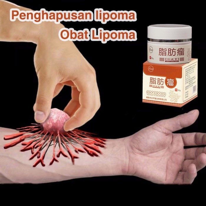 obat lipoma benjolan obat benjolan lipoma salep lipoma salep benjolan