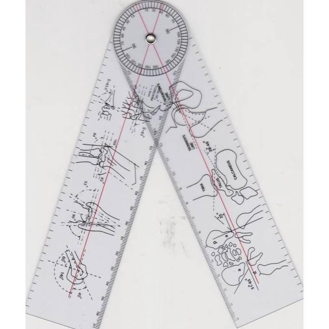 

Goniometer alat fisioterapi/ penggaris sudut